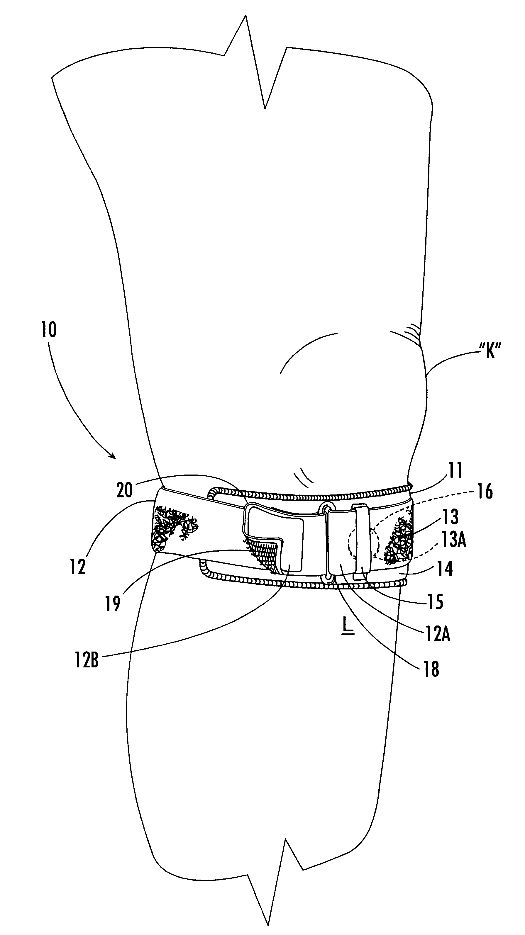 Custom-moldable support for patellar tendinitis