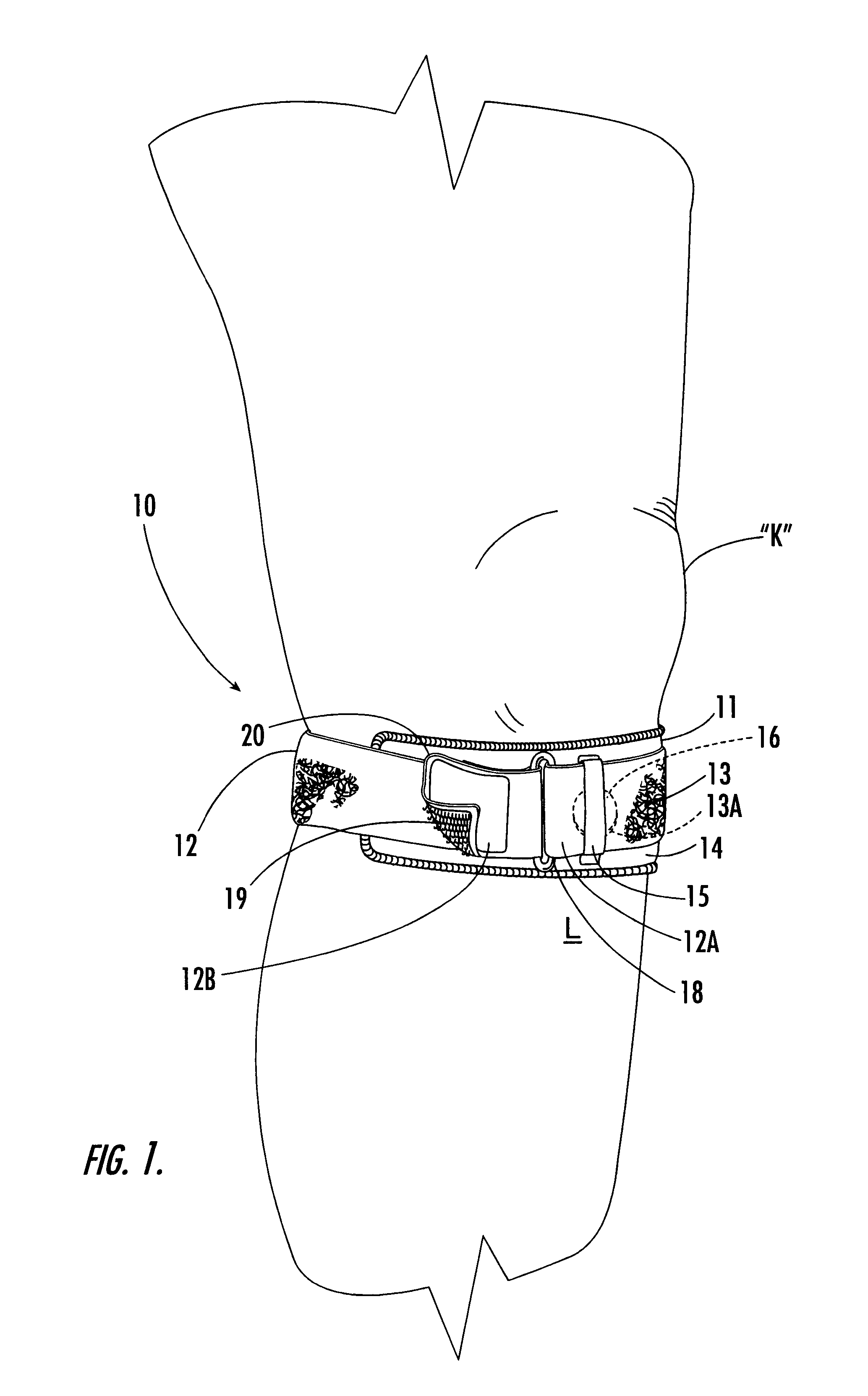 Custom-moldable support for patellar tendinitis