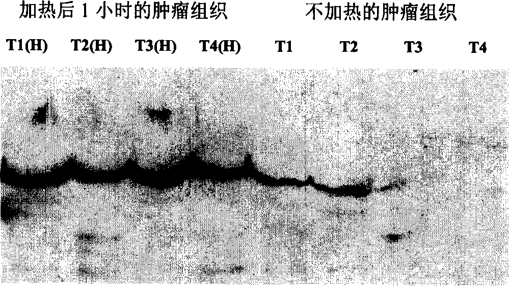 Preparation of antigen sensitized human dendron shaped cell and its use