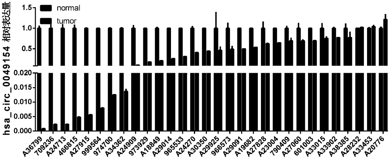 Application of hsa_circ_0049154 as prostatic cancer molecular target in preparation of drug and kit