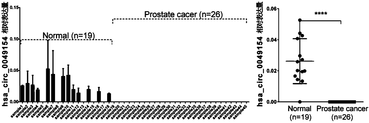 Application of hsa_circ_0049154 as prostatic cancer molecular target in preparation of drug and kit