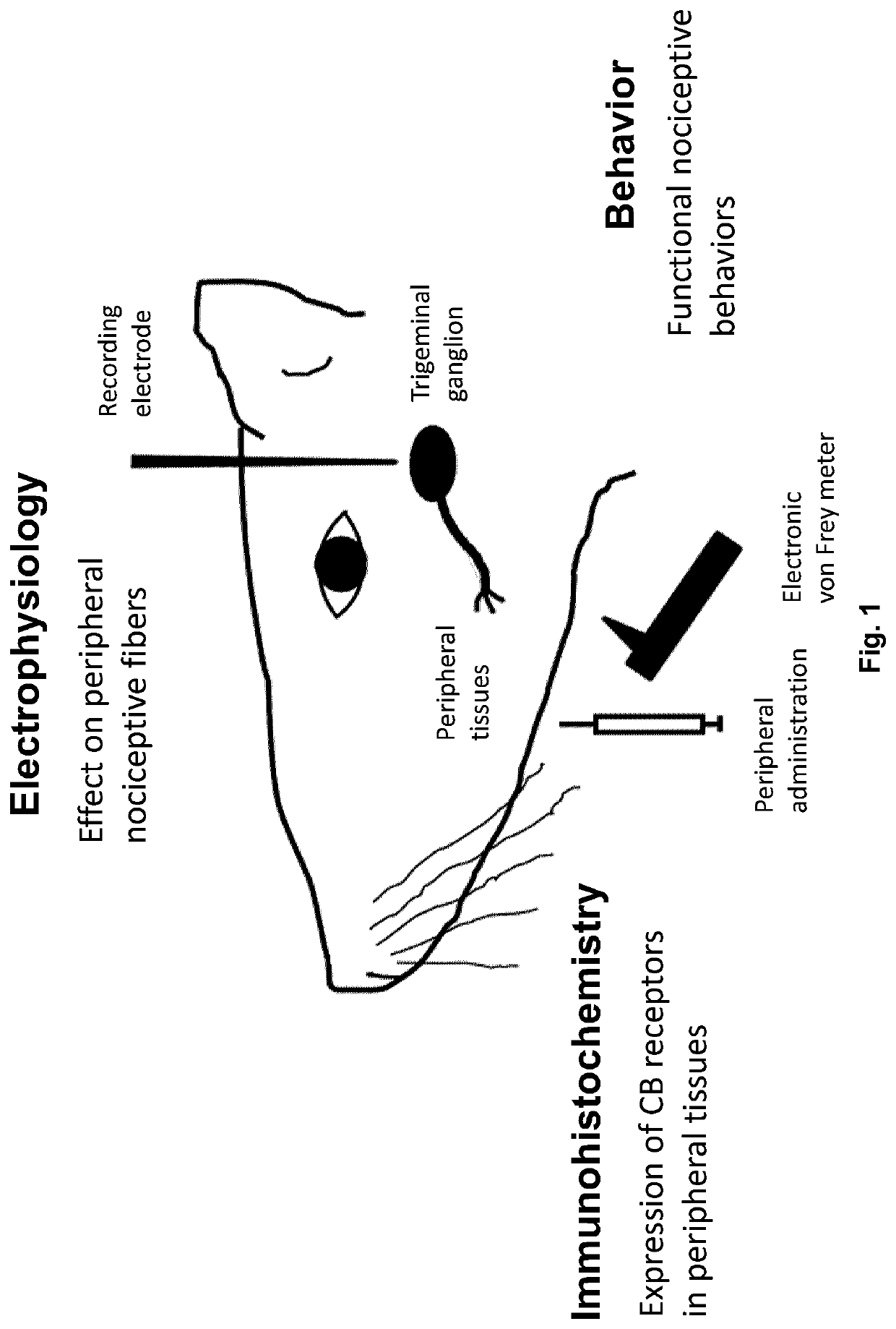 Topical formulations of cannabinoids and use thereof in the treatment of pain