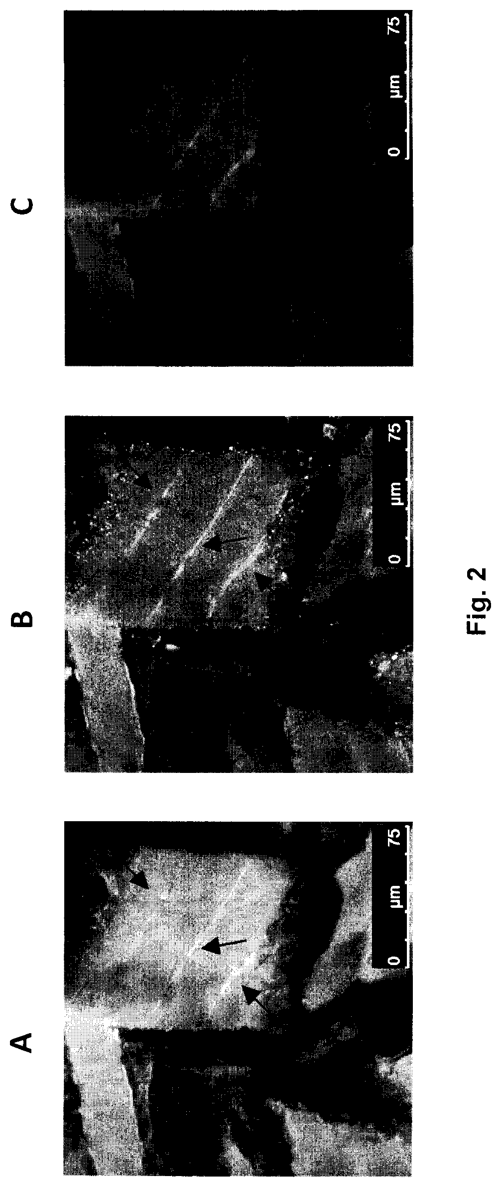 Topical formulations of cannabinoids and use thereof in the treatment of pain