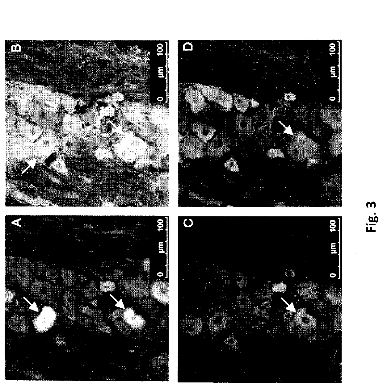 Topical formulations of cannabinoids and use thereof in the treatment of pain