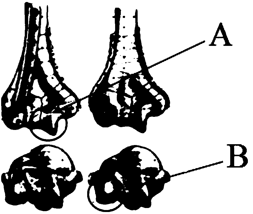 Distal humeral outer plate