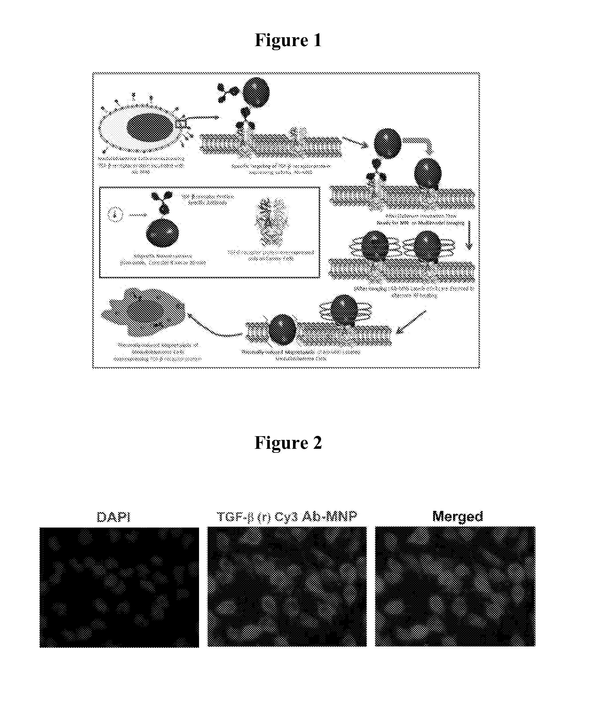 Magnetic nanostructures as theranostic agents