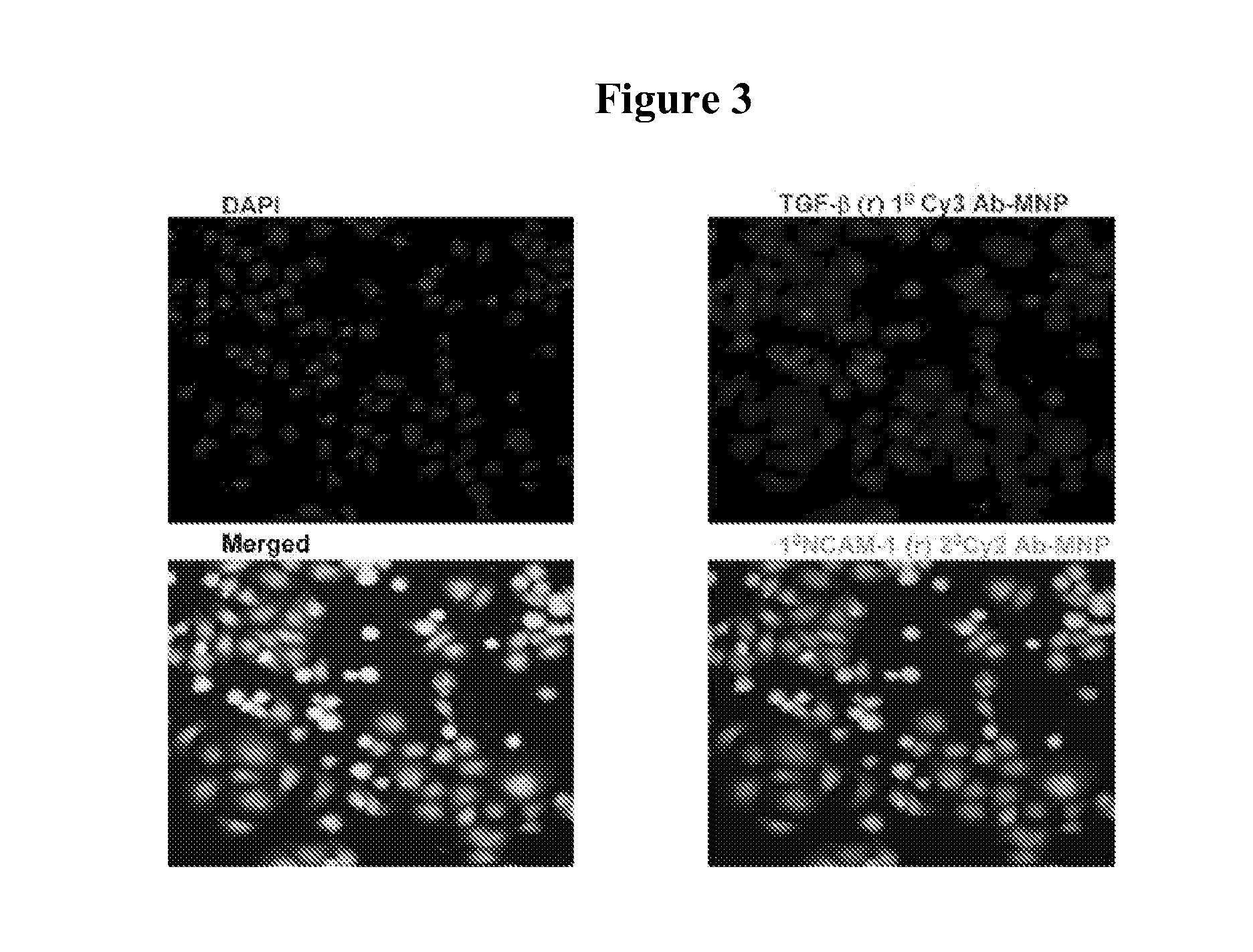 Magnetic nanostructures as theranostic agents