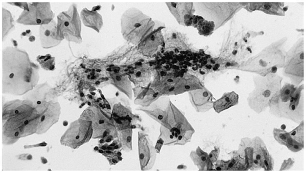 Papanicolaou staining kit and its staining method