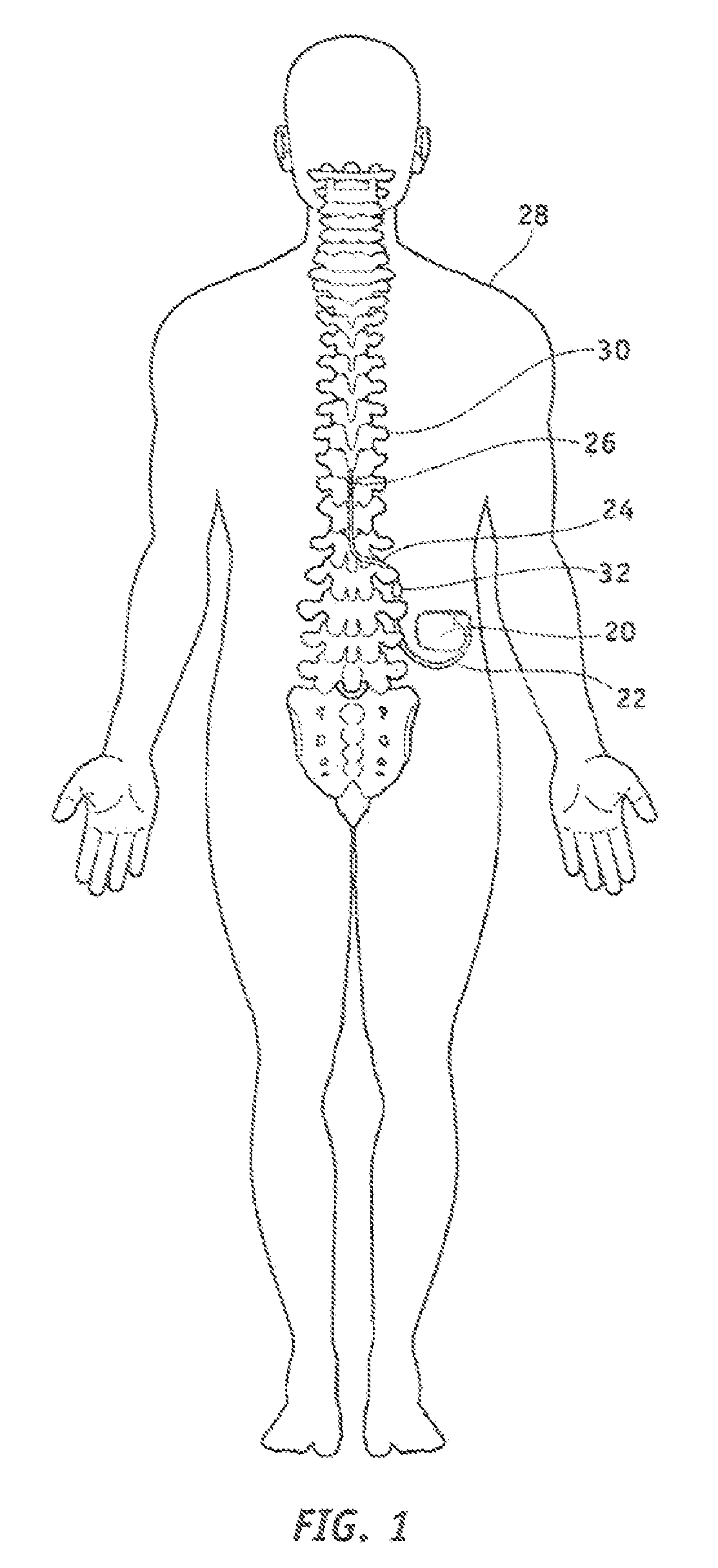 Internal hermetic lead connector for implantable device