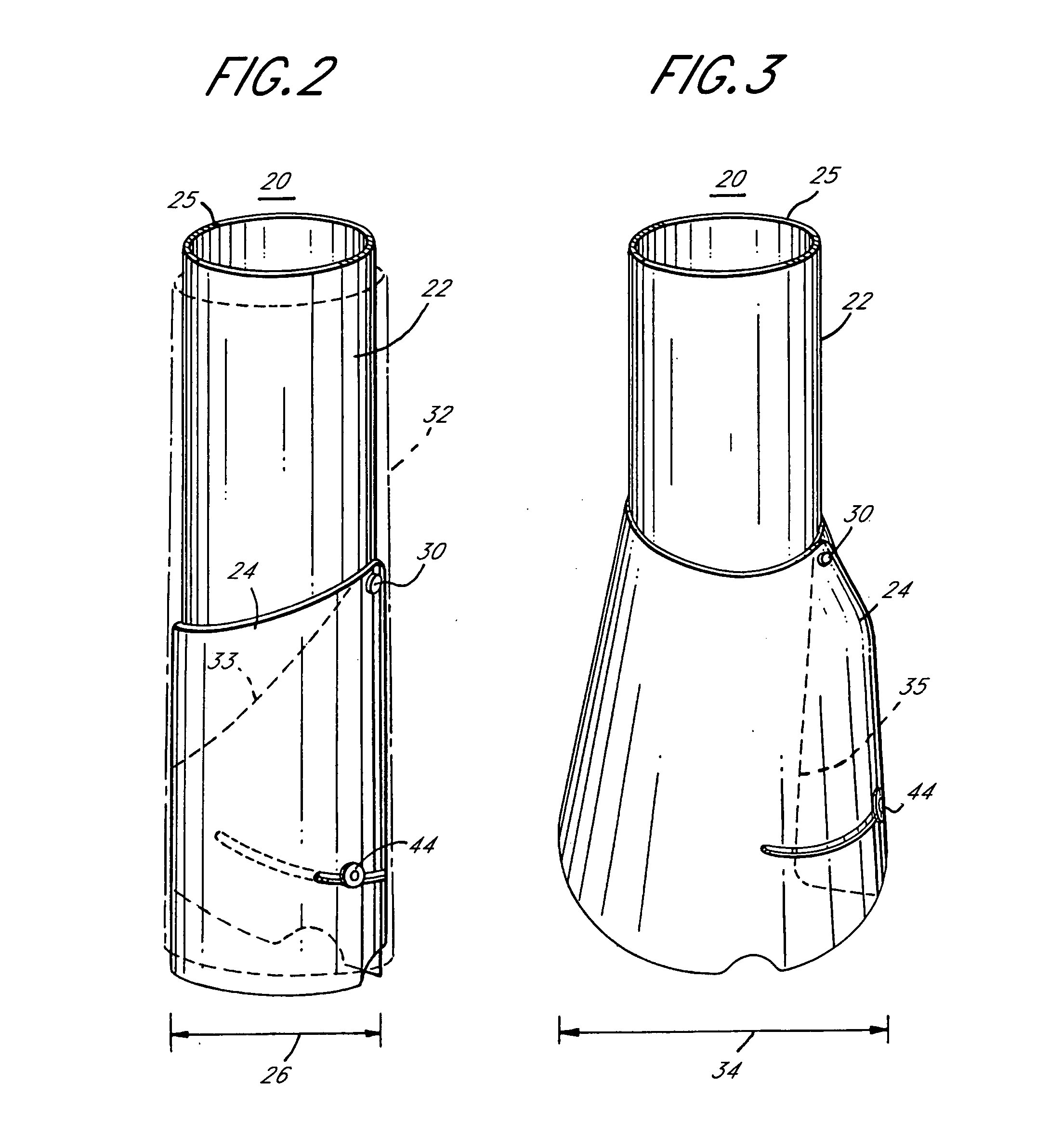 Methods and apparatuses for minimally invasive replacement of intervertebral discs