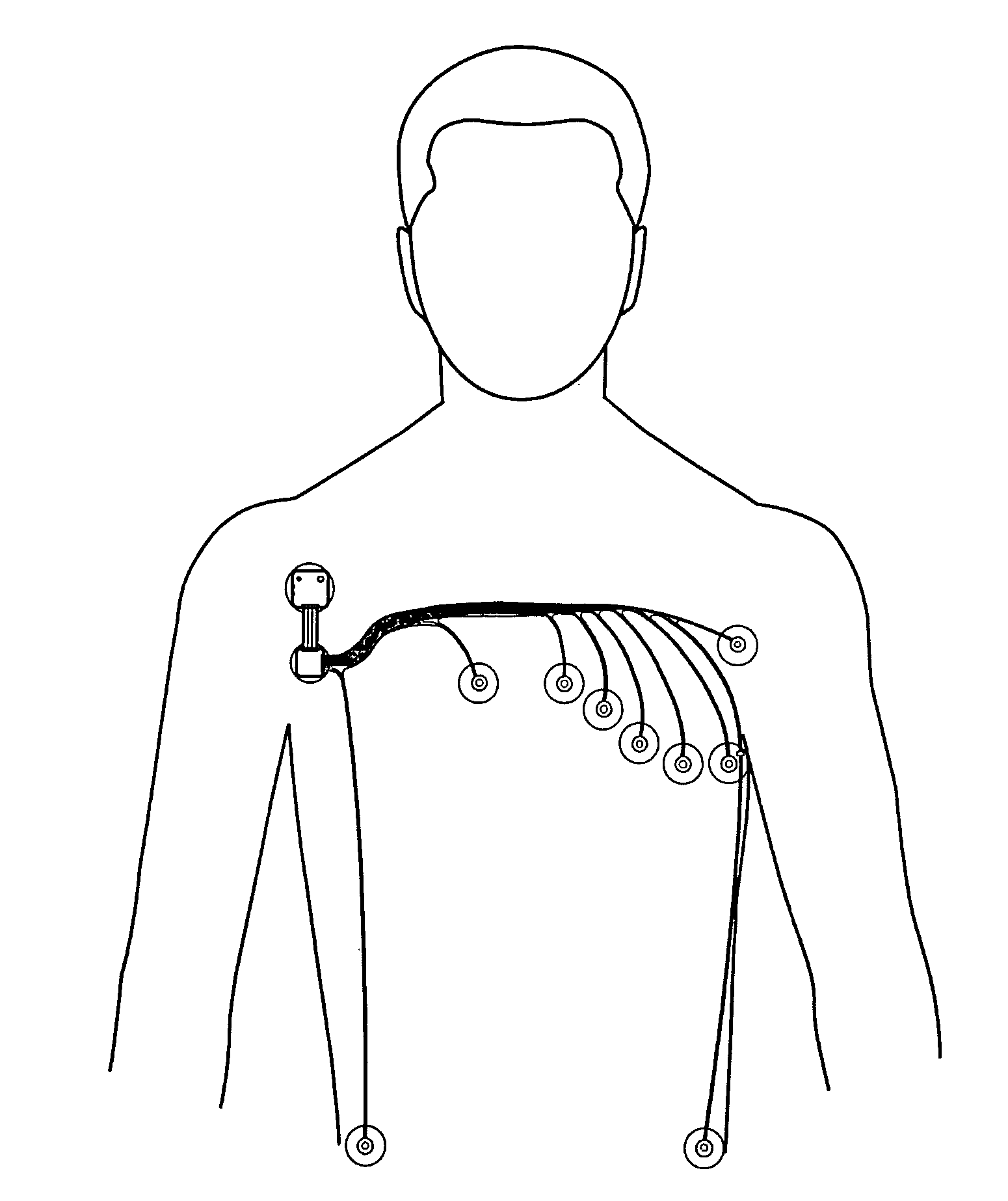 Patch-type physiological monitoring apparatus, system and network