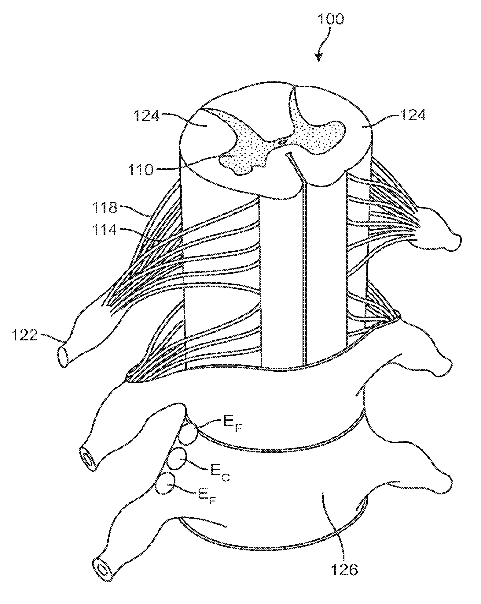 Methods and devices for treatment of non-neuropathic conditions using electrical stimulation