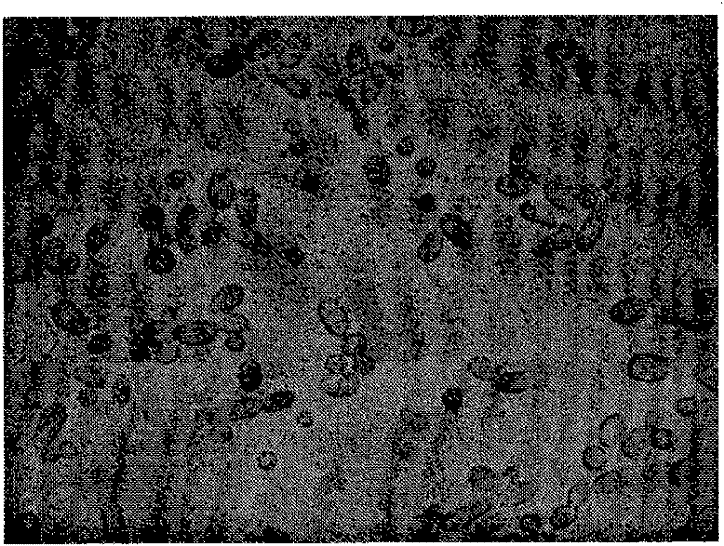 Pichia farinose strain FL7 capable of dissolving inorganic phosphorus compounds and application thereof