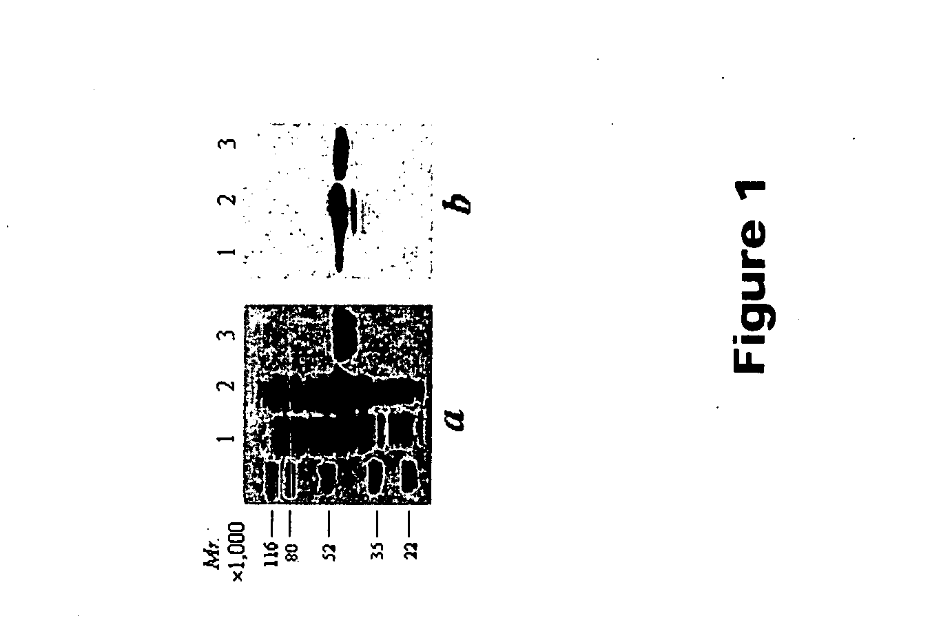 Compounds useful in treating diabetic microvascular complications and age-related macular degeneration