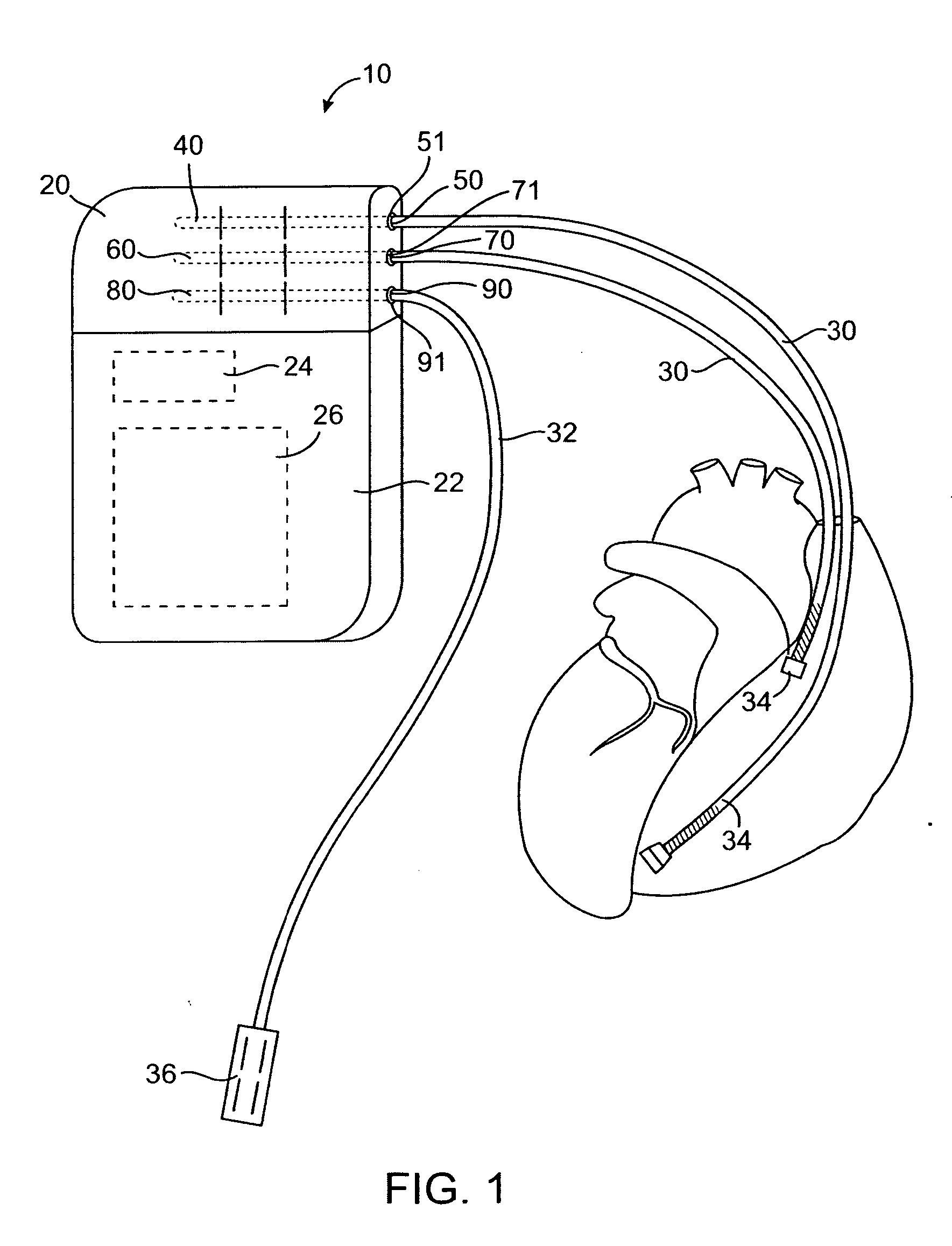 Lockout connector arrangement for implantable medical device