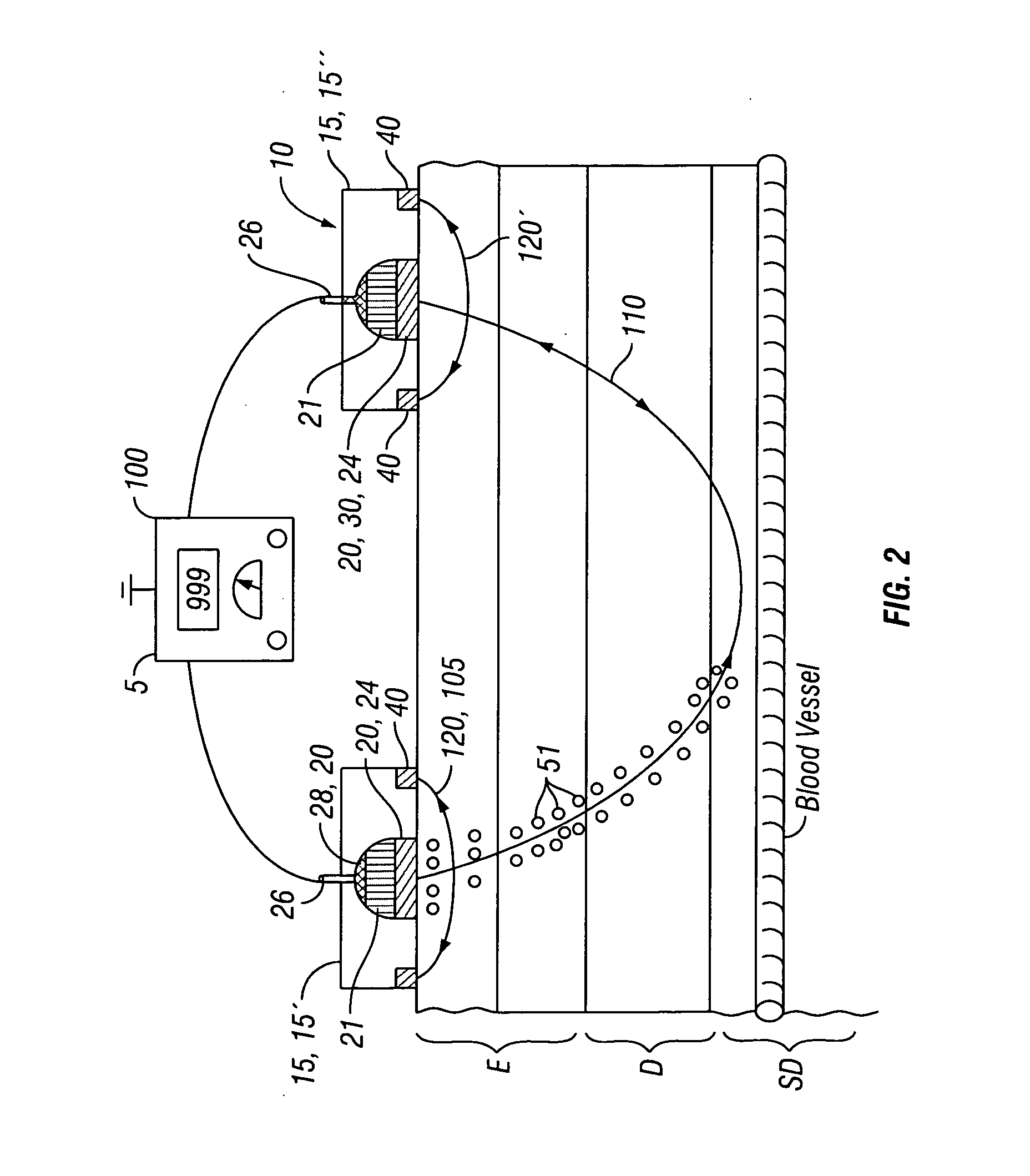 Method and apparatus for oscillatory iontophoretic transdermal delivery of a therapeutic agent