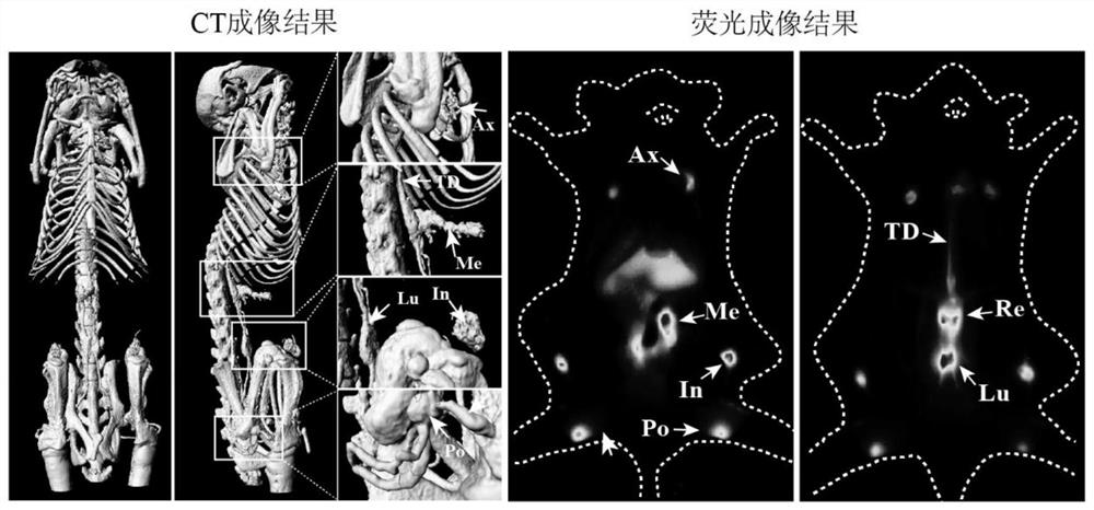 A kind of nanoparticle targeting whole-body multilevel lymph nodes, preparation method and application