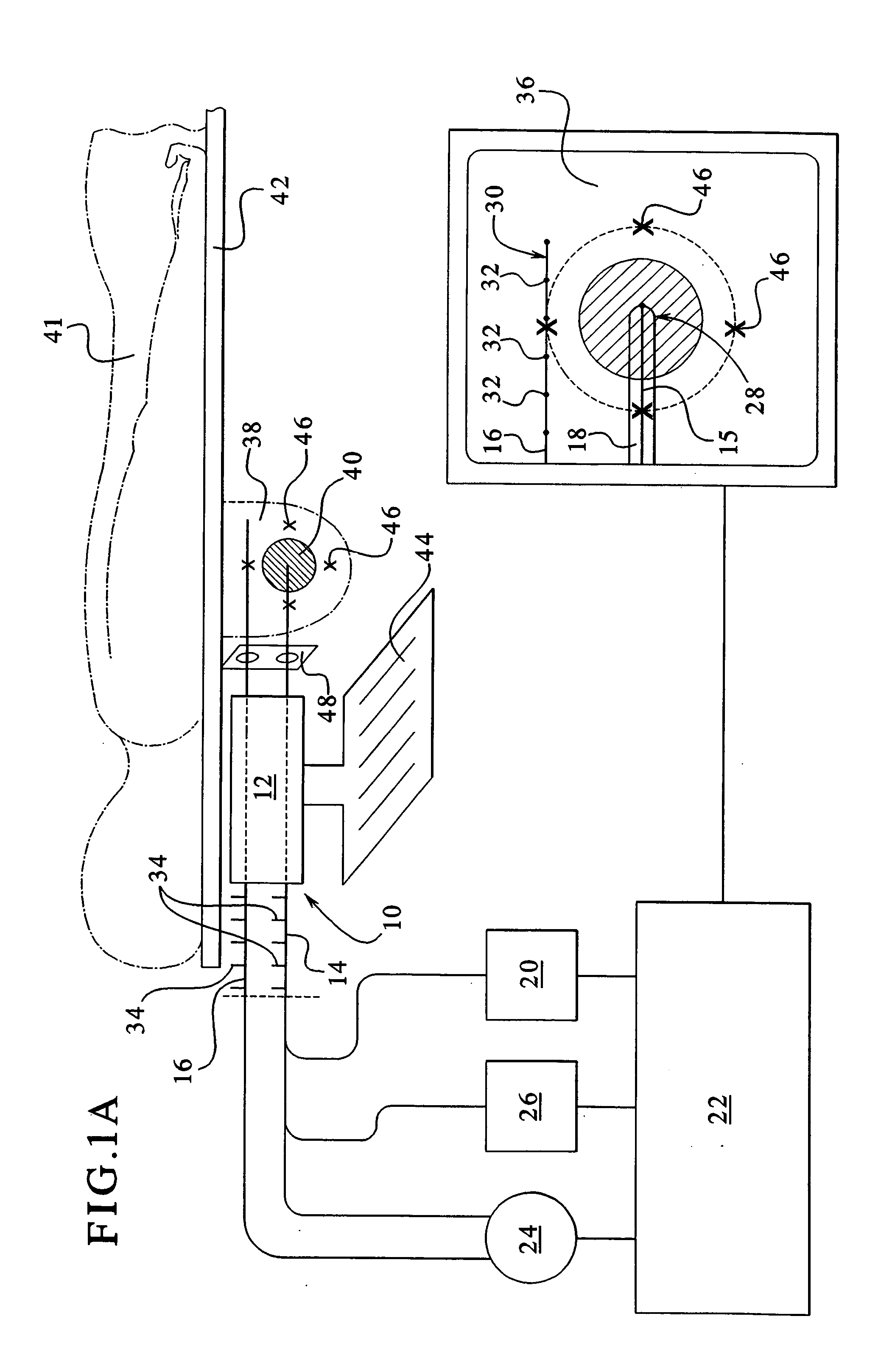 Apparatus and method for delivering ablative laser energy and determining the volume of tumor mass destroyed