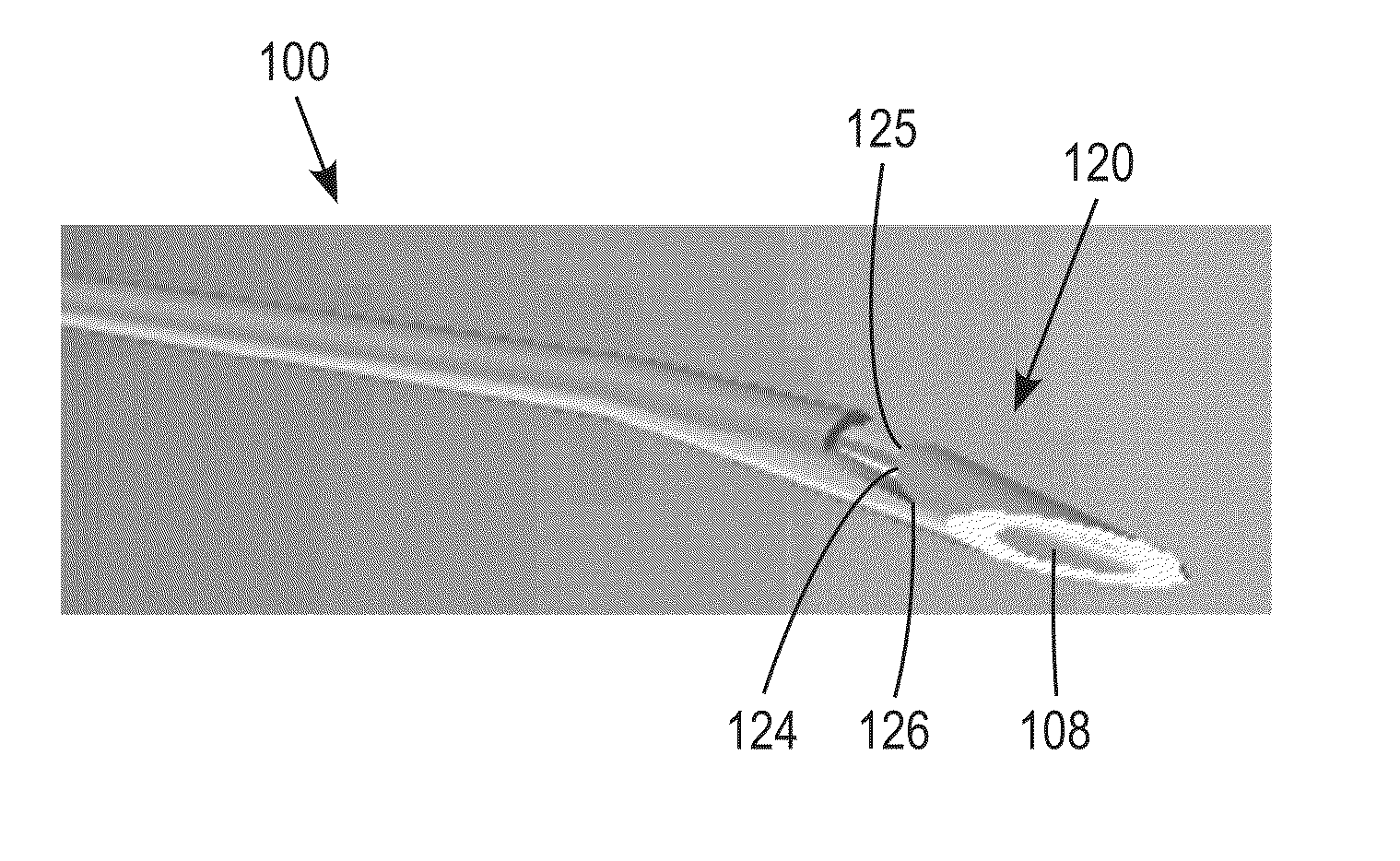 Method and apparatus for trabeculectomy and suprachoroidal shunt surgery