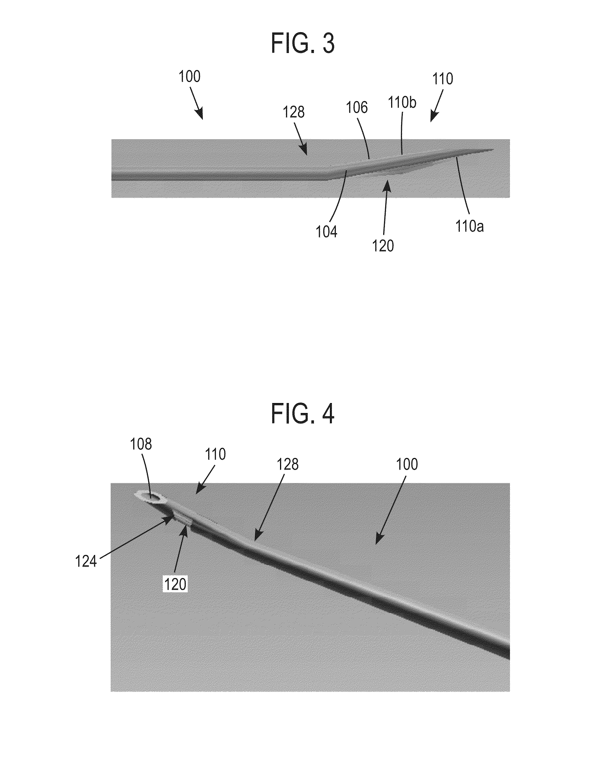 Method and apparatus for trabeculectomy and suprachoroidal shunt surgery