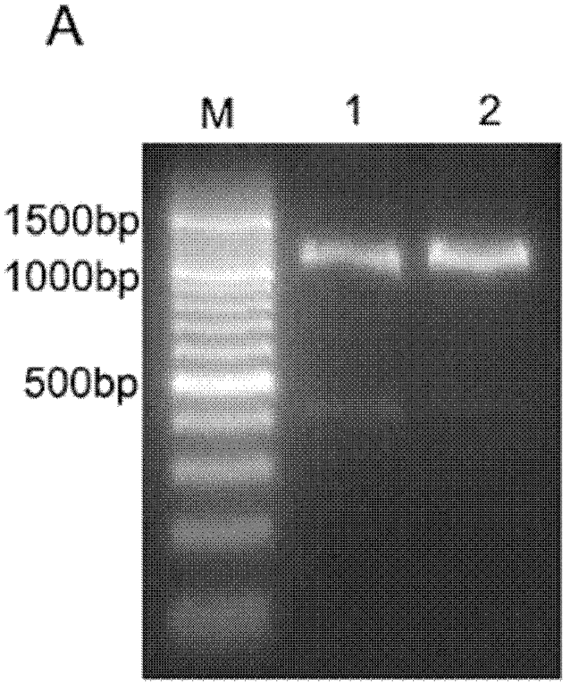 Immune nano-carrier for conveying siRNA (small interfering Ribonucleic Acid) and preparation method and application thereof