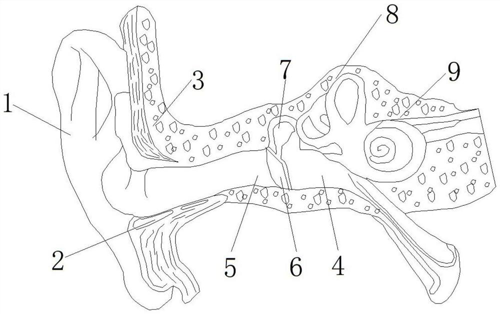 A test method for optimization of hearing reconstruction scheme using simulation mold