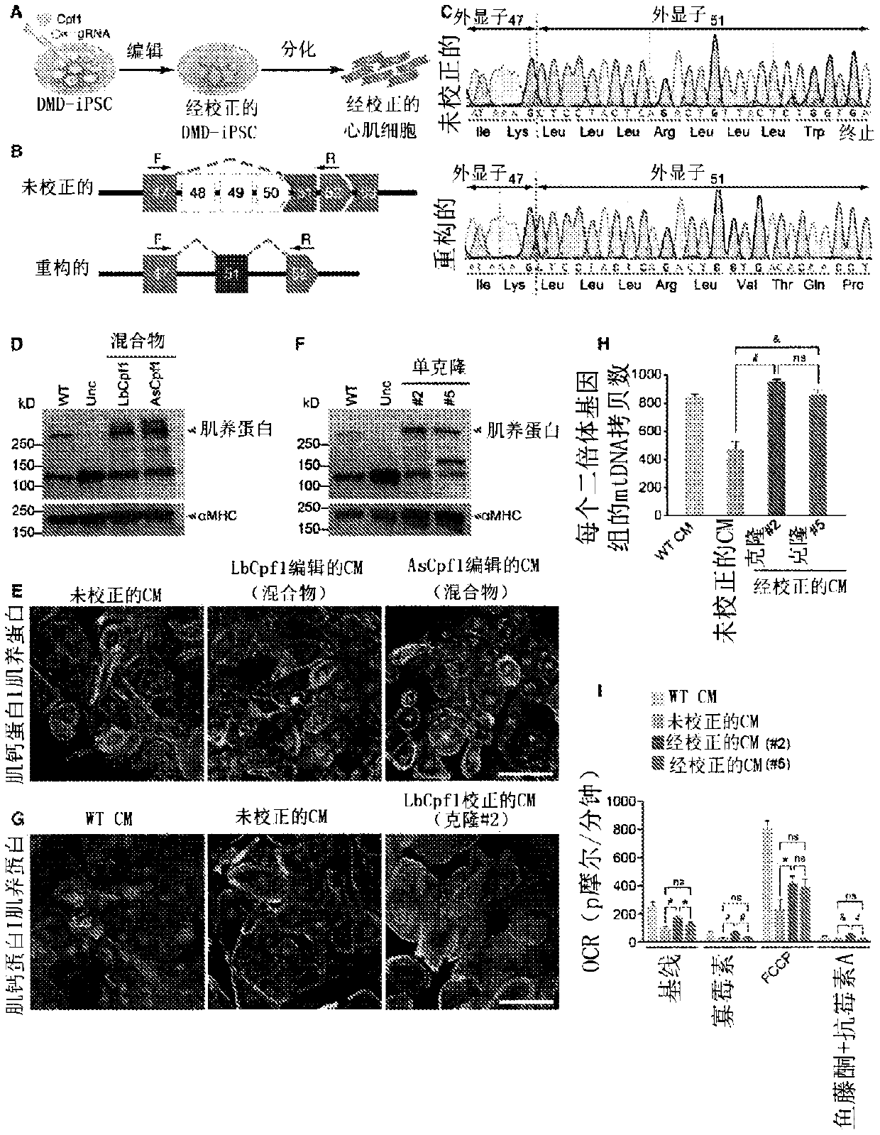 Prevention of muscular dystrophy by crispr/cpf1-mediated gene editing