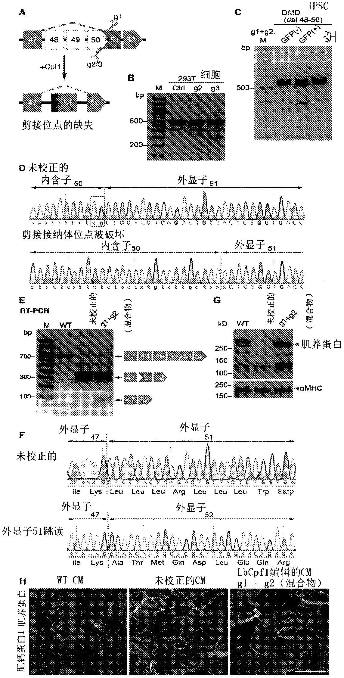 Prevention of muscular dystrophy by crispr/cpf1-mediated gene editing