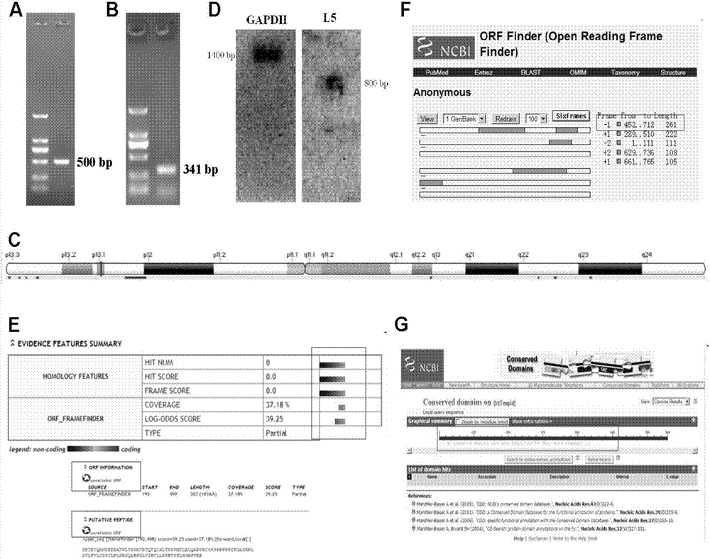 Long-chain non-coding RNA (Ribonucleic Acid) correlated to occurrence and development of human hepatocellular carcinoma, amplification detection method and application