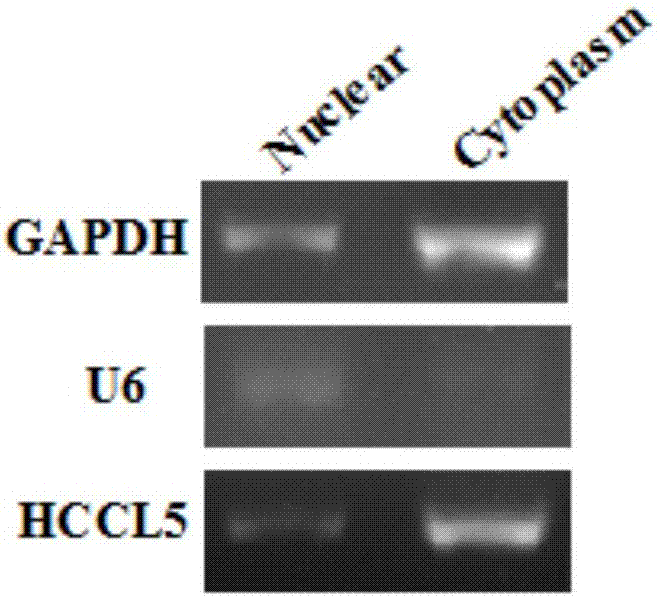 Long-chain non-coding RNA (Ribonucleic Acid) correlated to occurrence and development of human hepatocellular carcinoma, amplification detection method and application