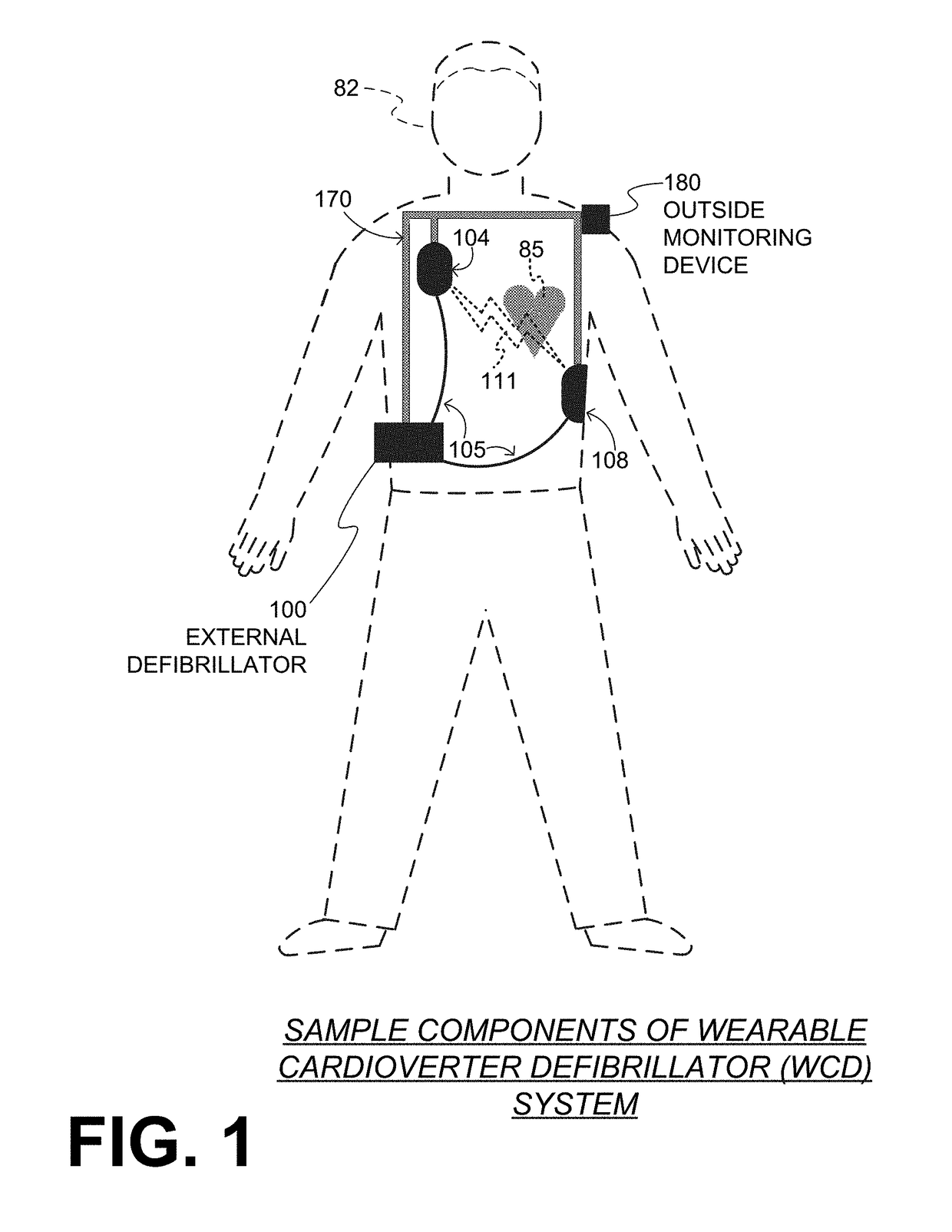 Wearable cardioverter defibrillator (WCD) system warning ambulatory patient by weak alerting shock