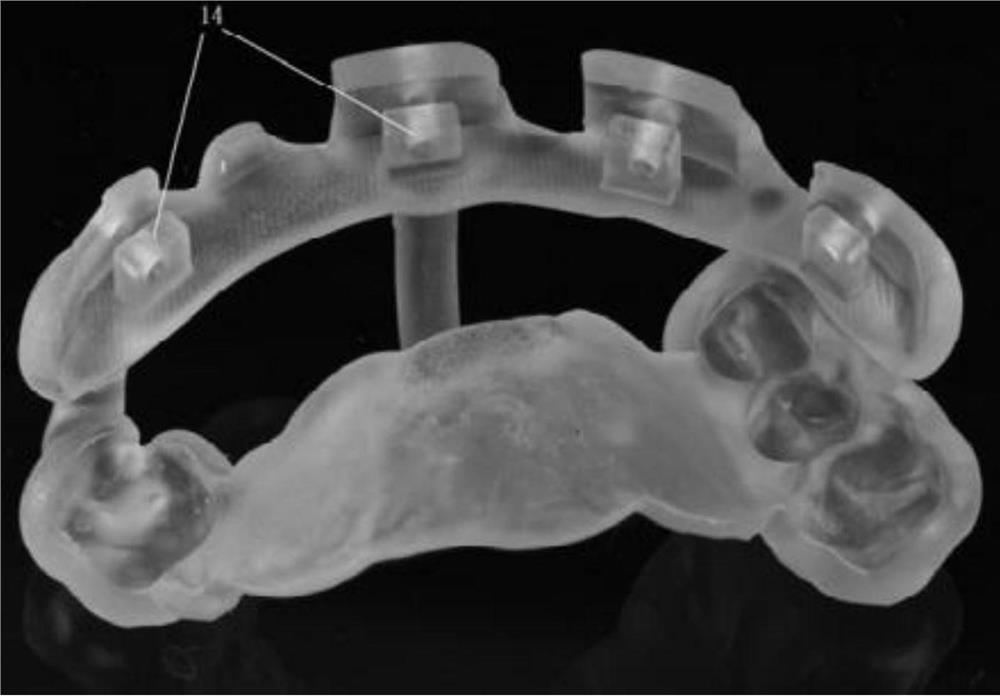 Whole-course digital combined guide plate suitable for full-mouth implant surgery