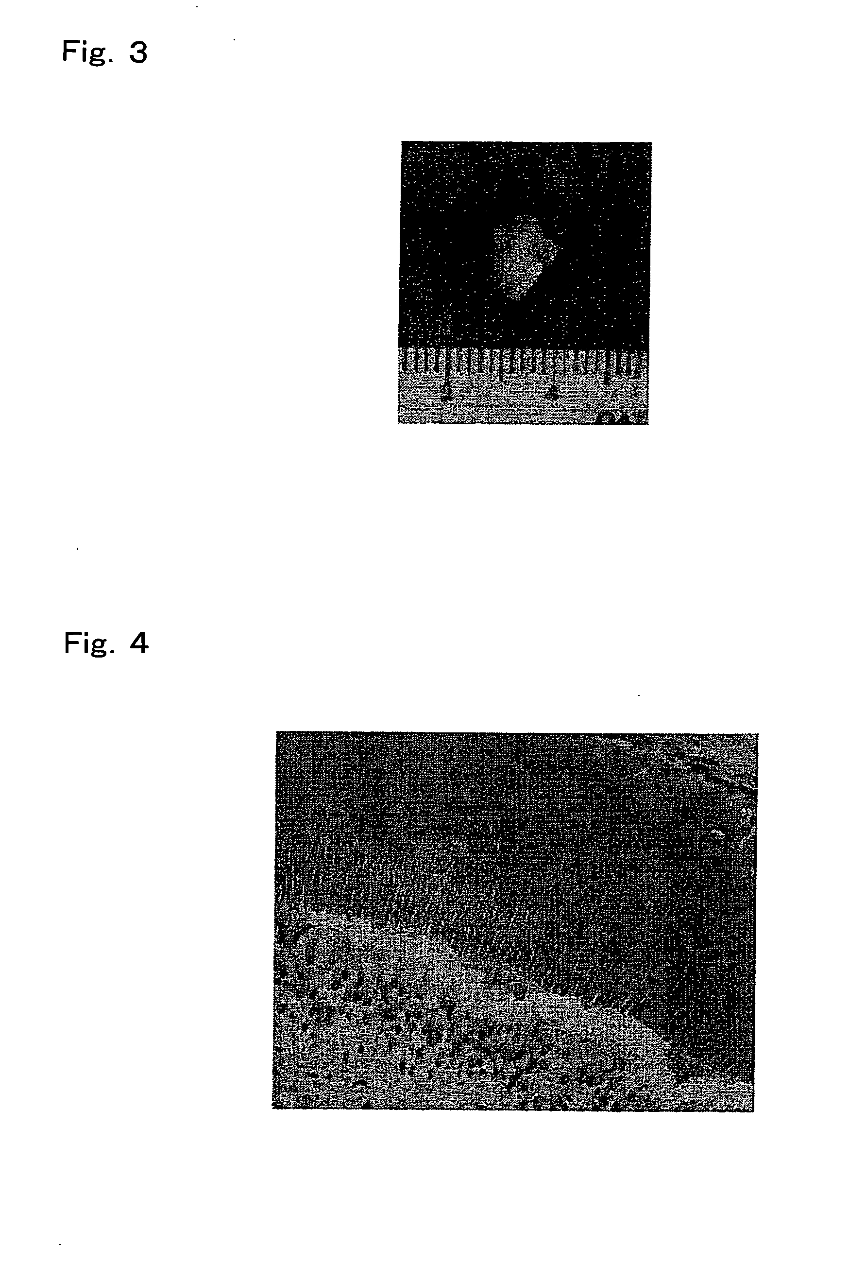 Method for regenerating tooth germ