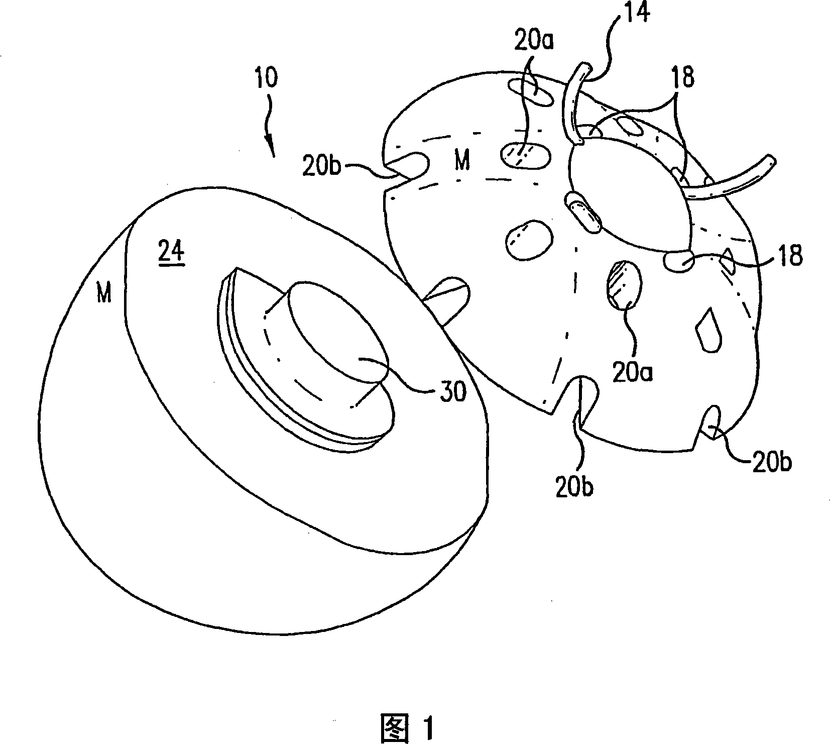 Quasi-spherical orbital implant