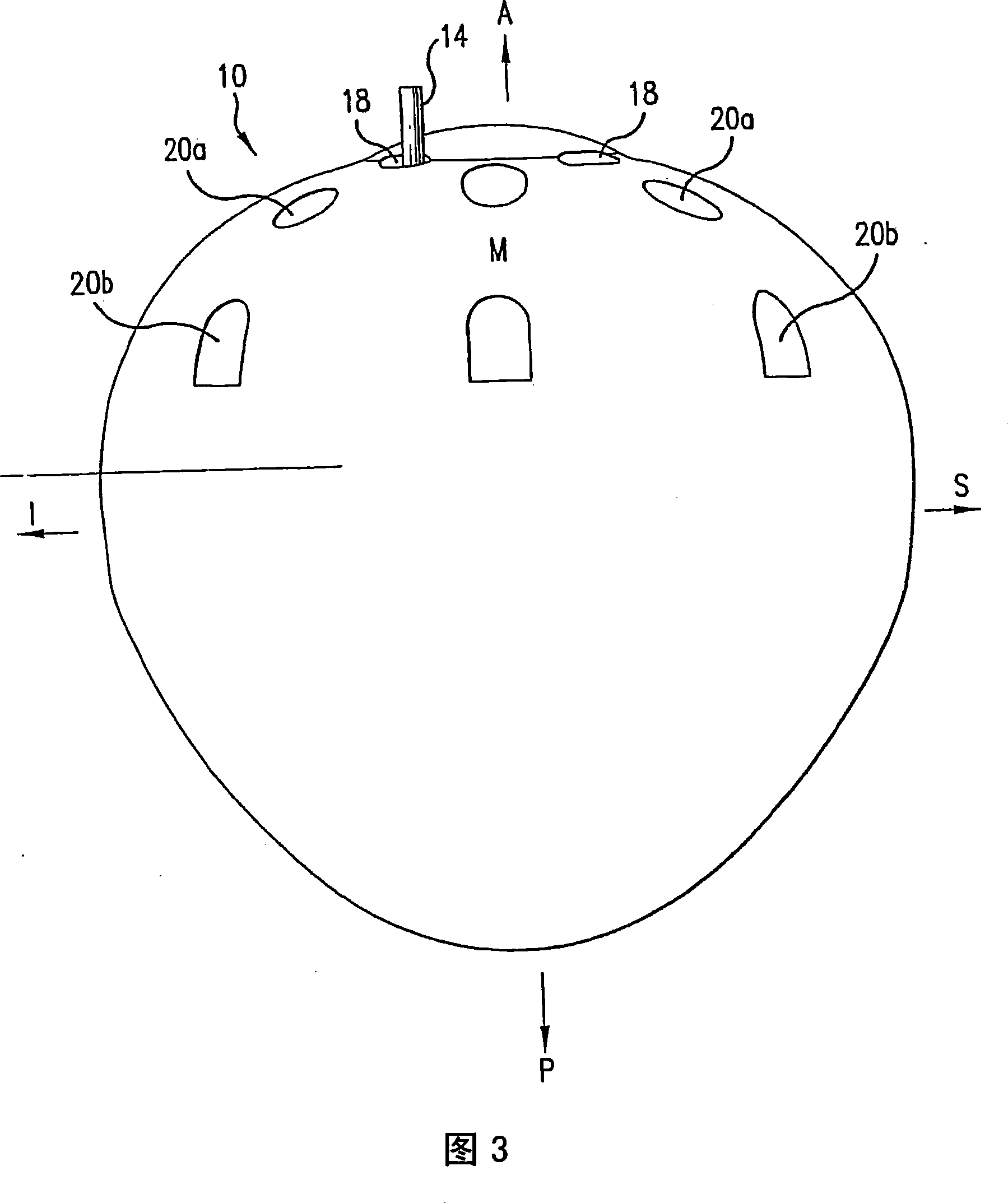 Quasi-spherical orbital implant