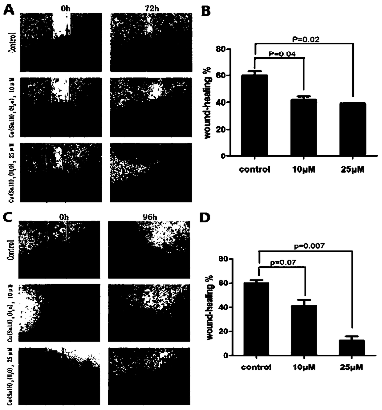 Application of 3,5-di-tert-butyl copper salicylate in the preparation of drugs for the treatment of highly metastatic breast cancer