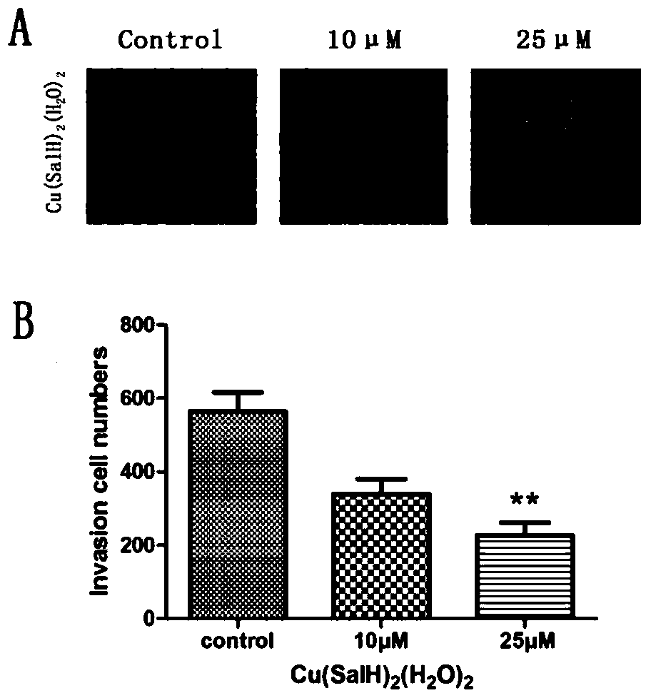 Application of 3,5-di-tert-butyl copper salicylate in the preparation of drugs for the treatment of highly metastatic breast cancer