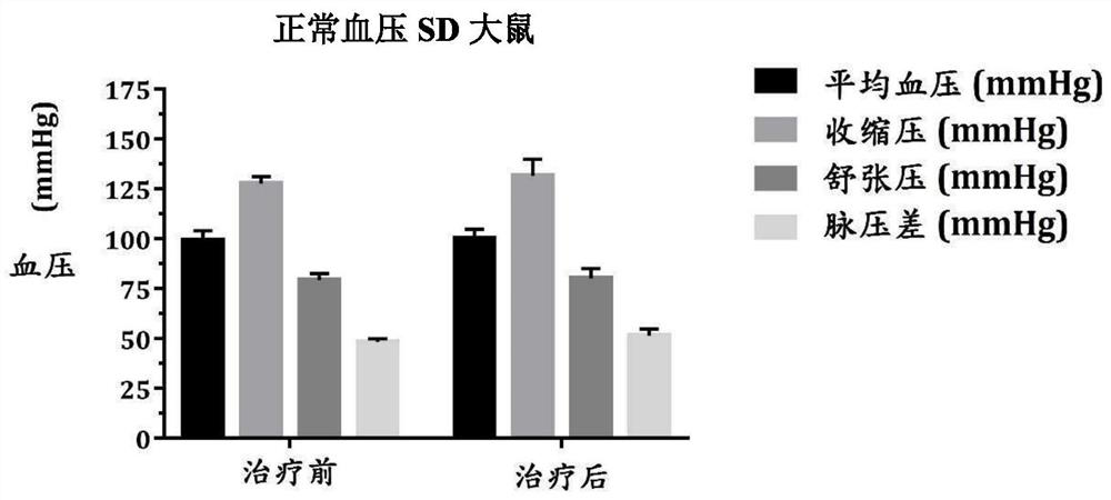 Application of ophioglossum and semen plantaginis composition to preparation of pharmaceutical composition for lowering blood sugar and blood pressure