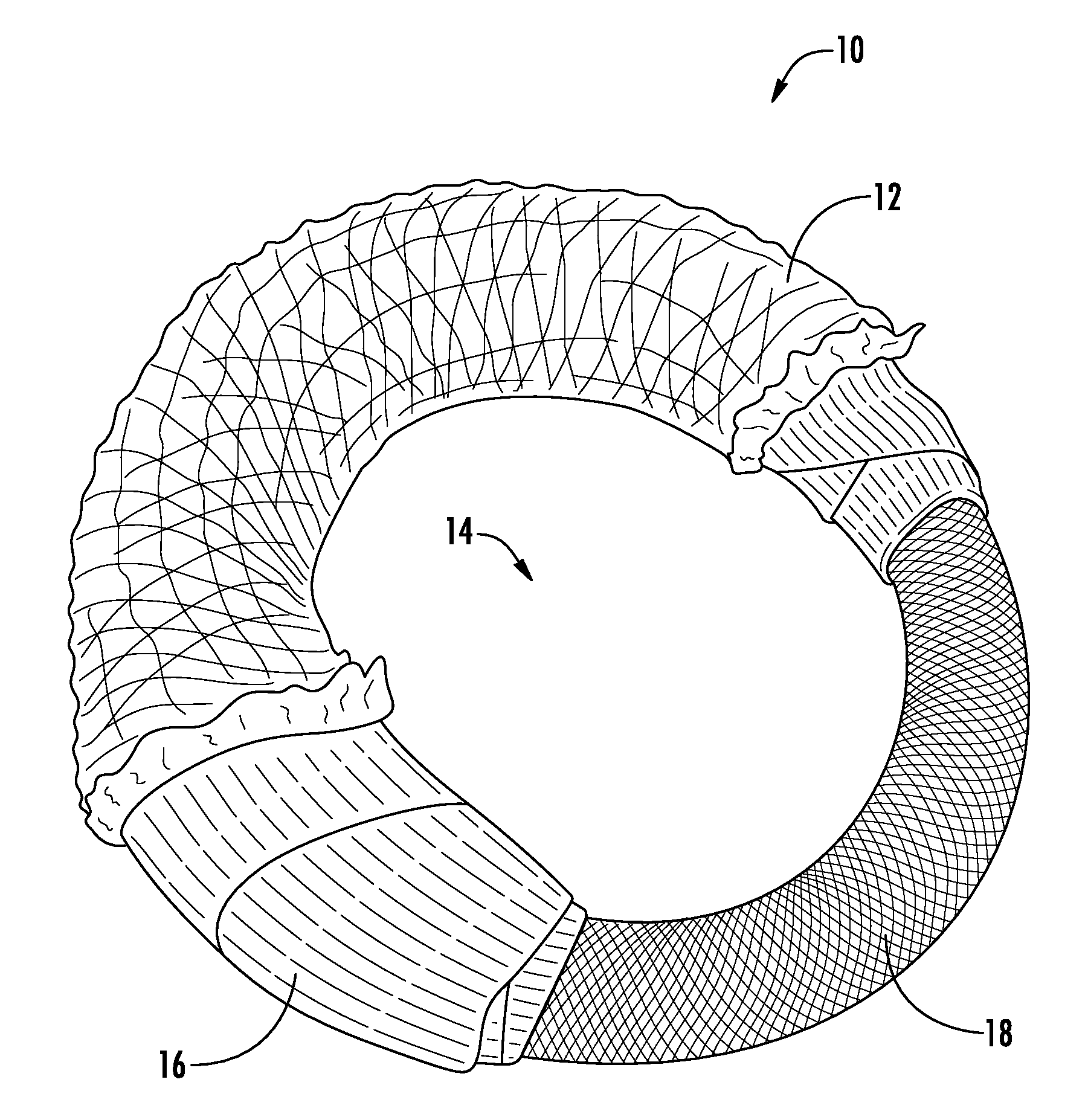 Ring compression bandage