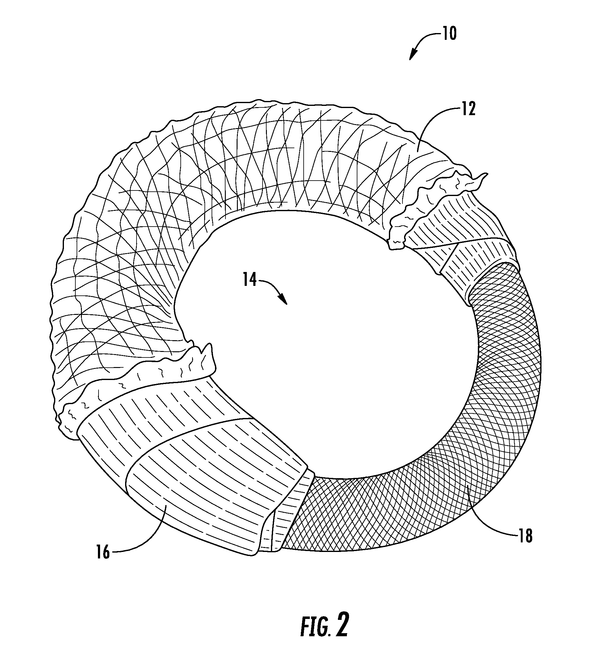 Ring compression bandage