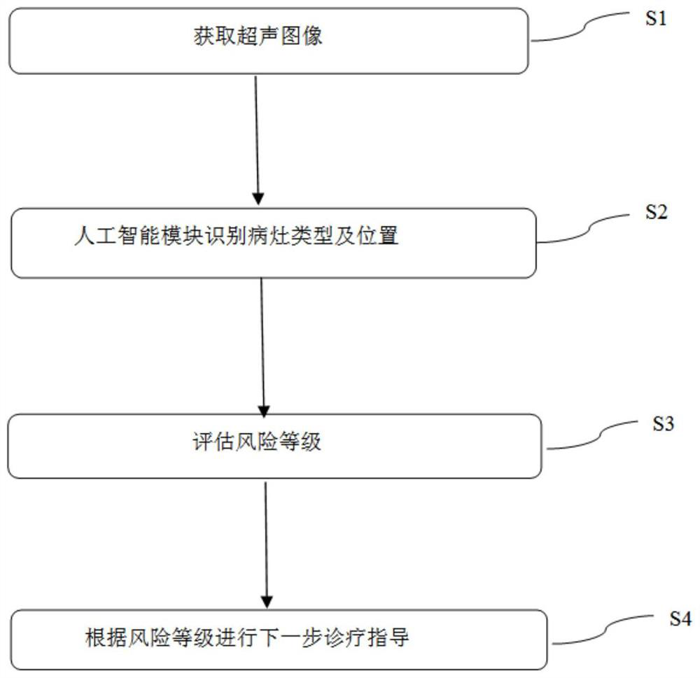 Ophthalmological ultrasonic automatic screening method and system based on deep learning