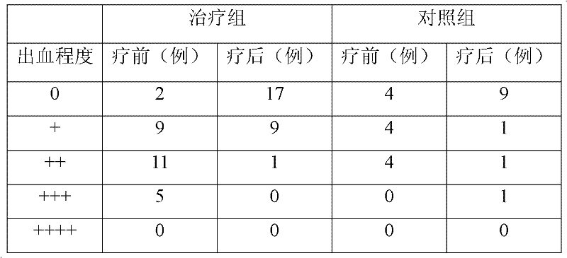 Pharmaceutical composition for treating thrombocytopenia, and preparation method and application thereof