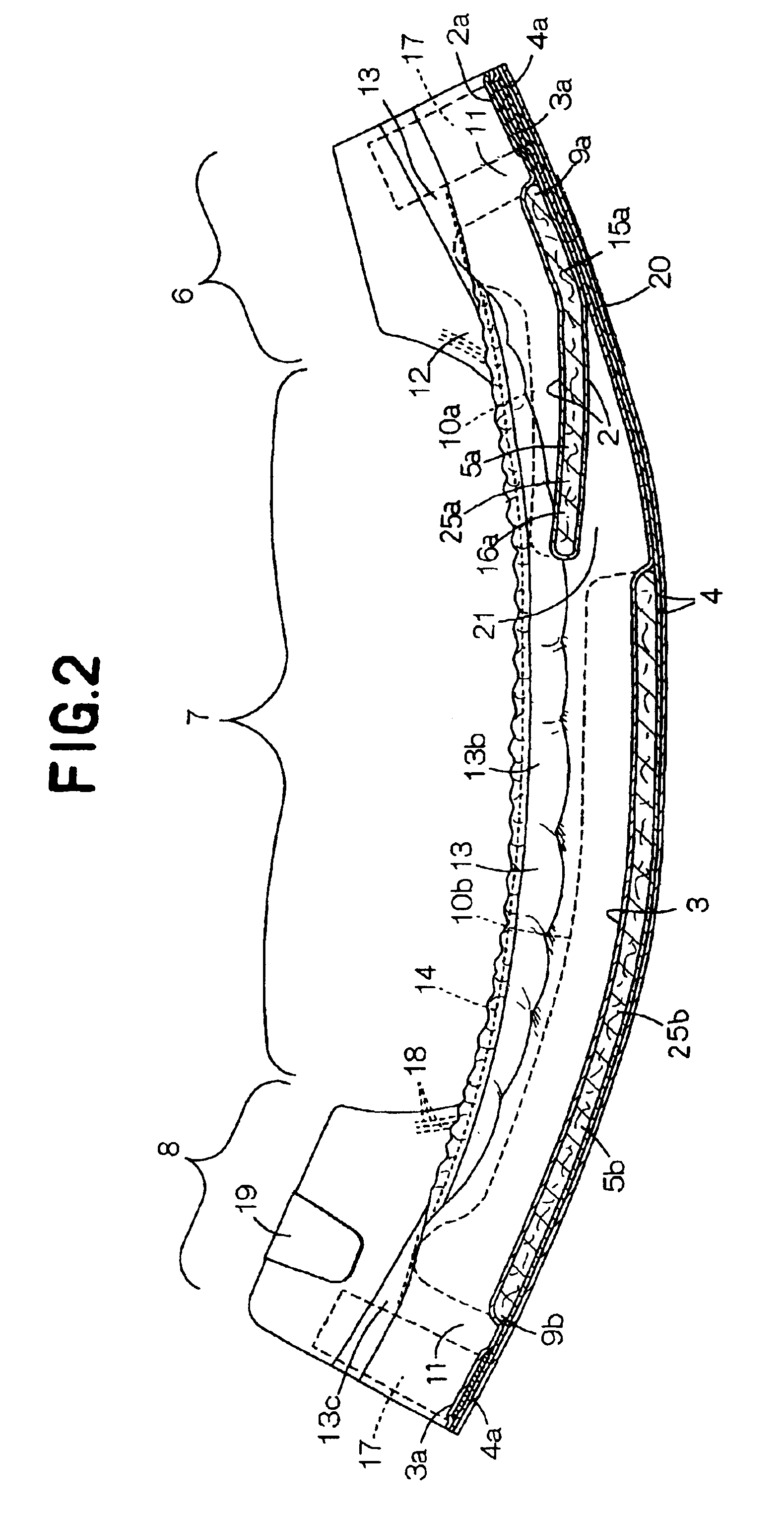 Disposable Absorbent Article With Excrement Receiving Pocket