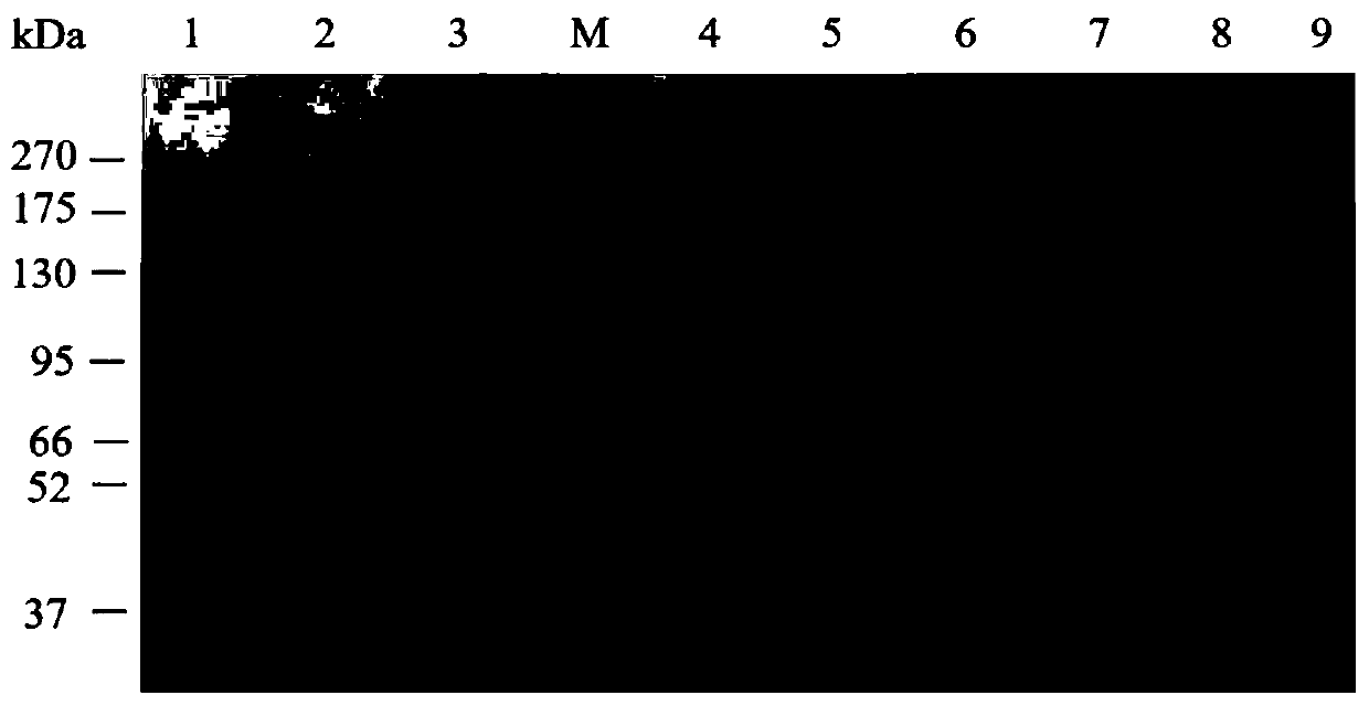 A kind of lipase mutant and its application in decontamination