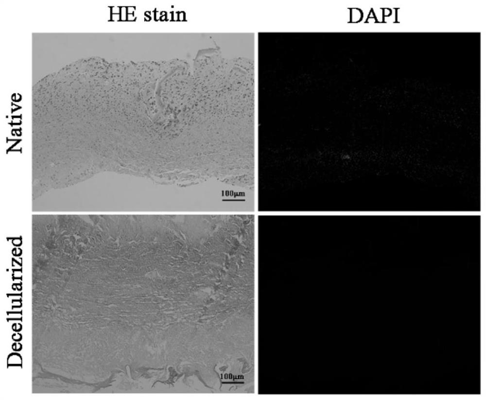 Preparation method of acellular periosteum matrix gel material derived from natural tissue