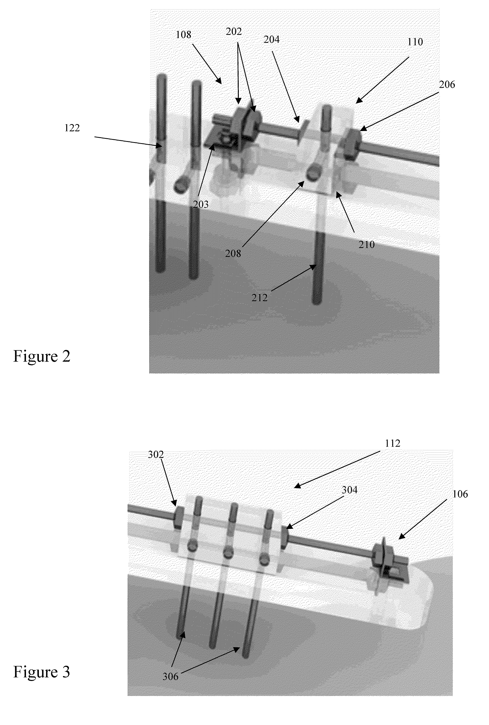 Bone Distraction System