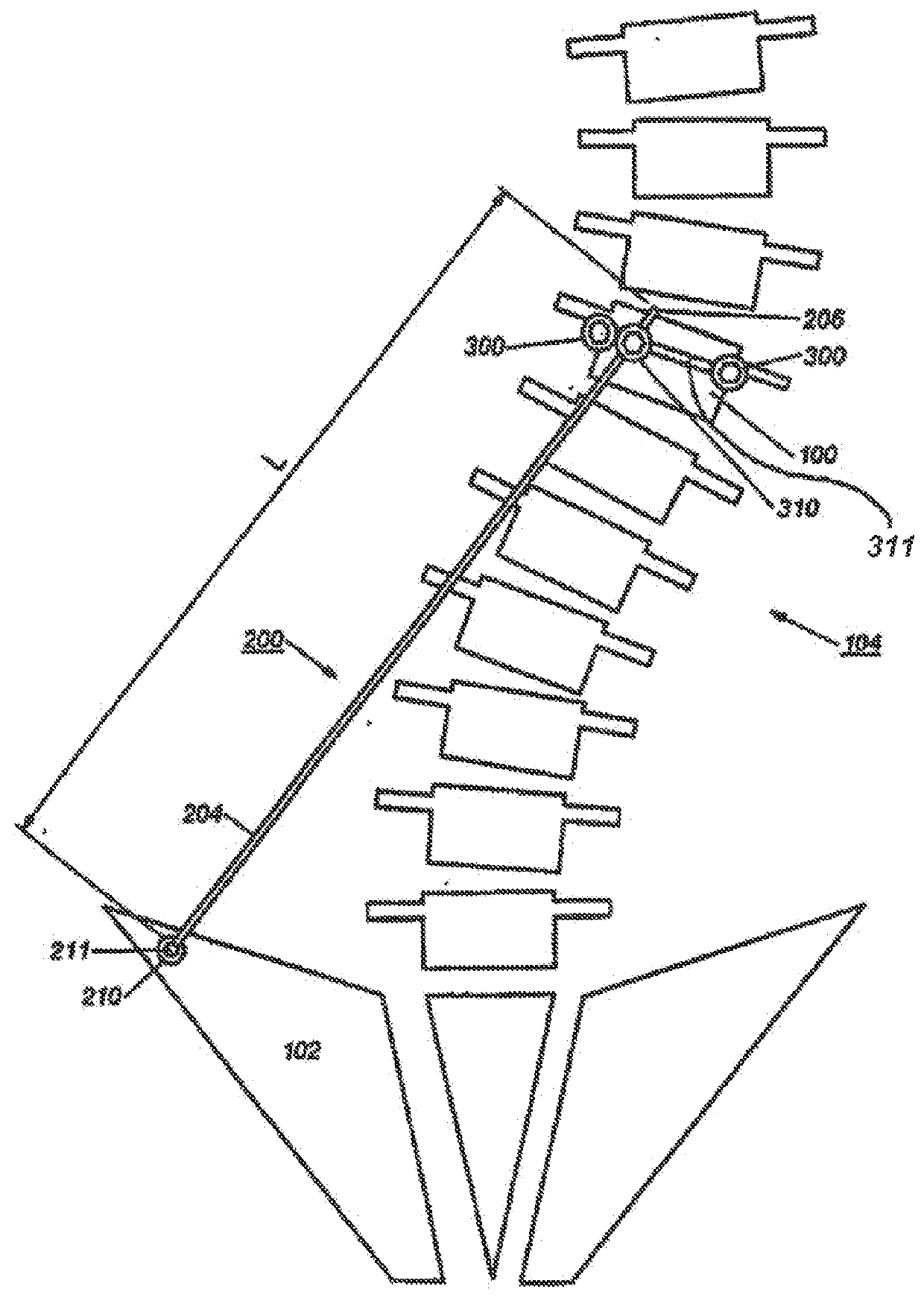 Device and method for treatment of spinal deformity