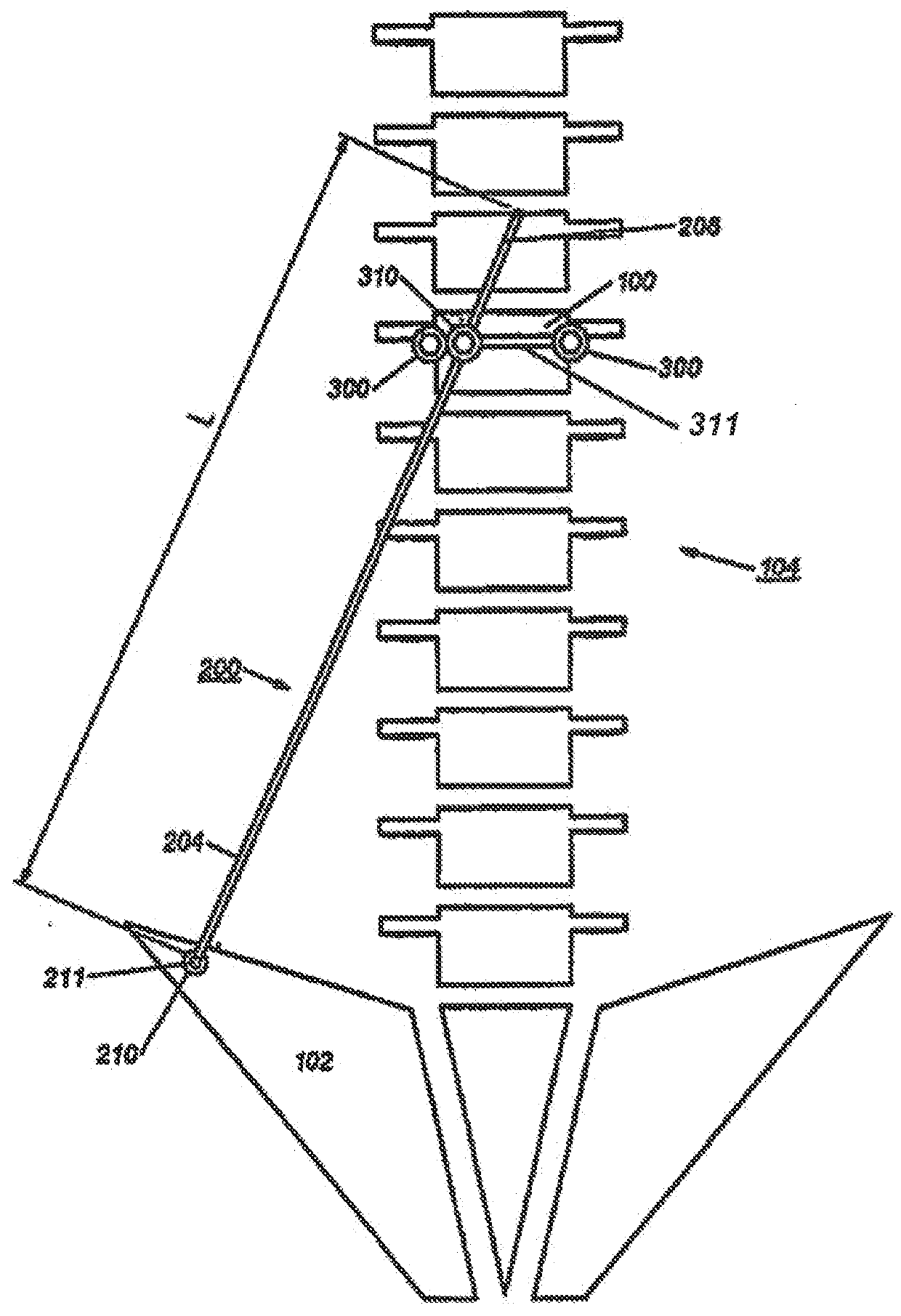 Device and method for treatment of spinal deformity