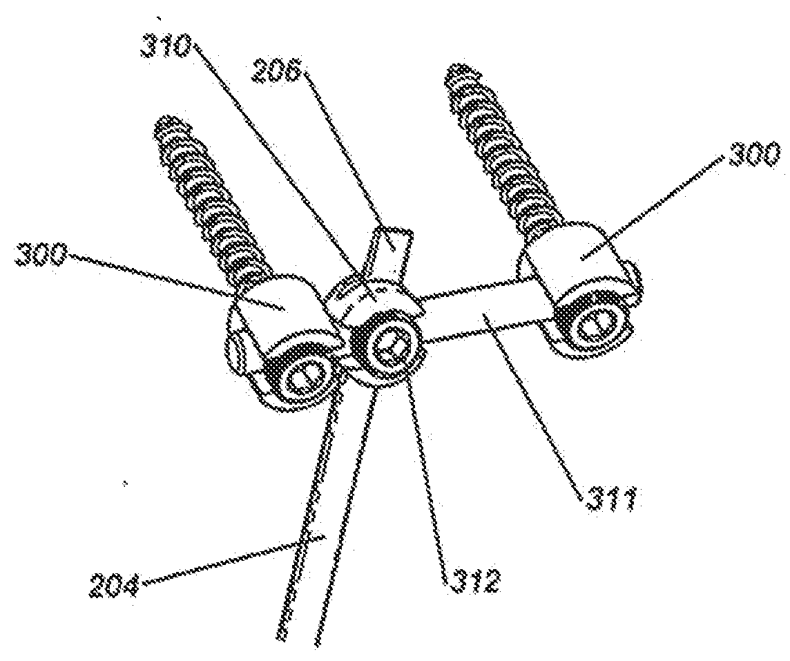 Device and method for treatment of spinal deformity