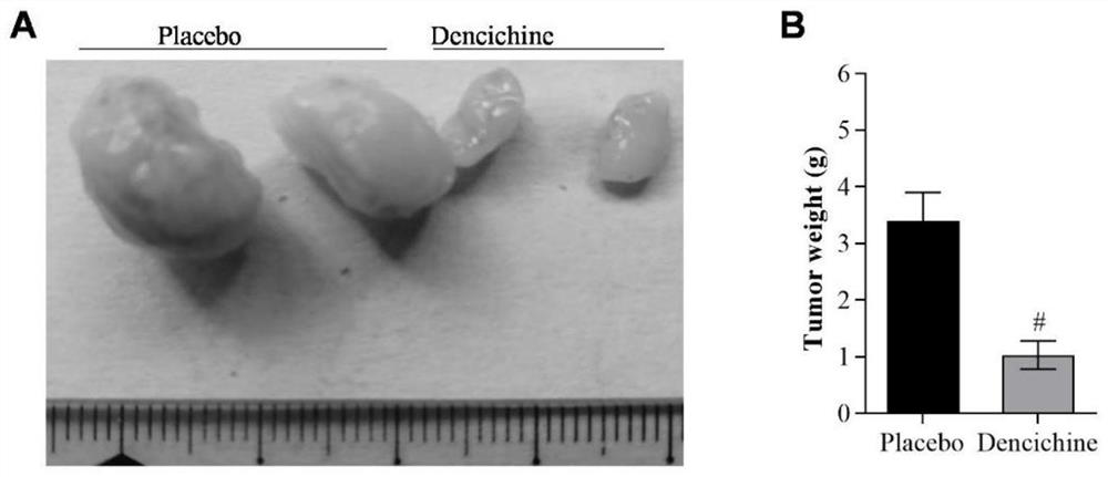 Application of Dencichine in preparation of biological medicine preparation for treating lung cancer